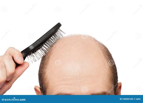 Bald man head stock photo. Image of head, hand, hairstyle - 24006160