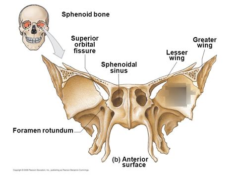 Sphenoid Sinus Diagram