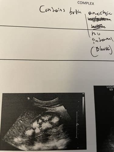 Sonography Flashcards Quizlet