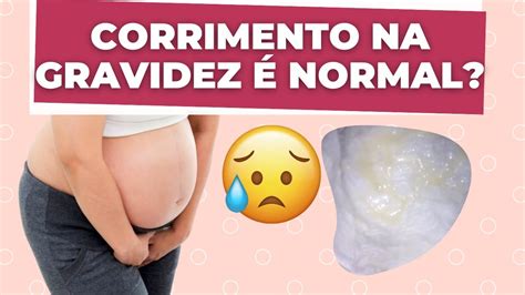 Corrimento Na Gravidez É Normal Quando Devo Me Preocupar Com O Corrimento Youtube