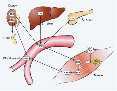 Creatinine - Radiometer