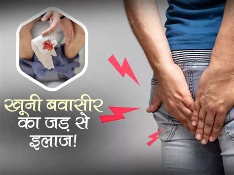 Bleeding Piles In Hindi खूनी बवासीर का जड़ से इलाज करने के लिए अपनाएं