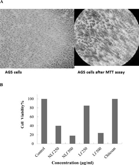 image   grown ags cell   microscope   magnification