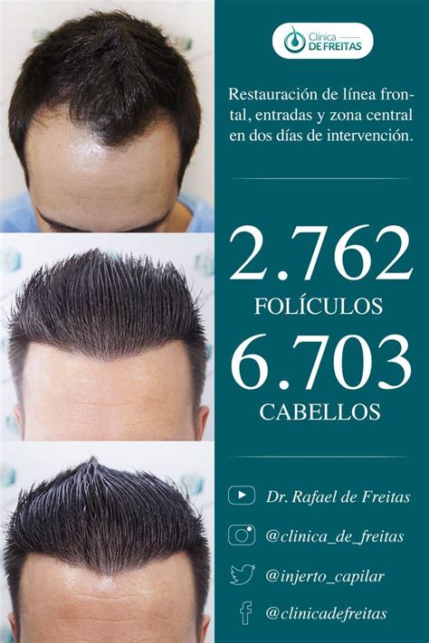 Puedes Lucir Nuevamente Un Cabello Sano Y Abundante