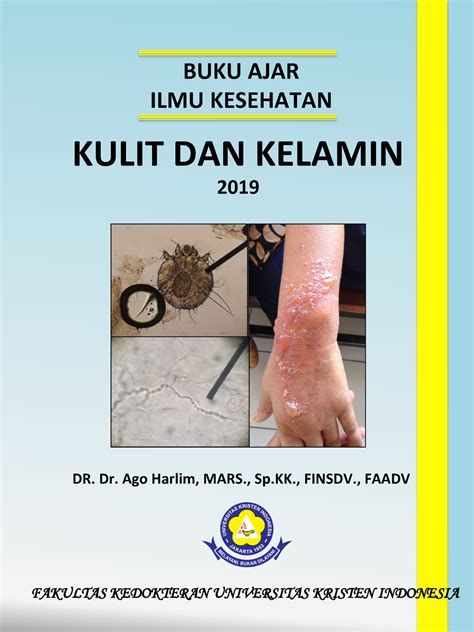 Buku Ajar Ilmu Kesehatan Kulit Dan Kelamin Fk Uki Buku Ajar Ilmu