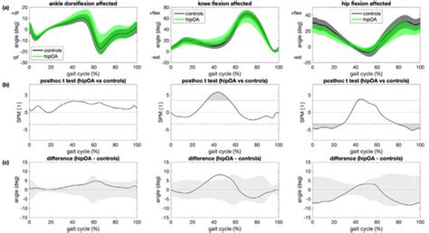 Sensors Free Full Text Assessing Site Specificity Of Osteoarthritic