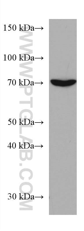 Atg Fusion Protein Ag Proteintech