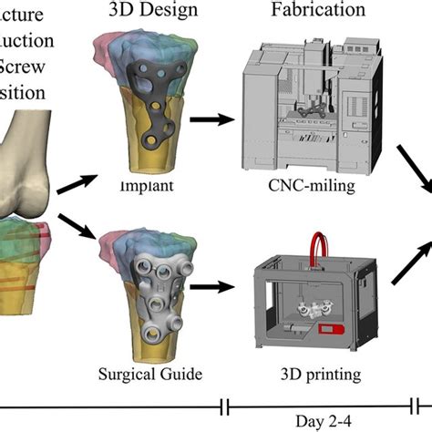 Workflow Of Manufacturing The Patient Specific Implant And The Download Scientific Diagram