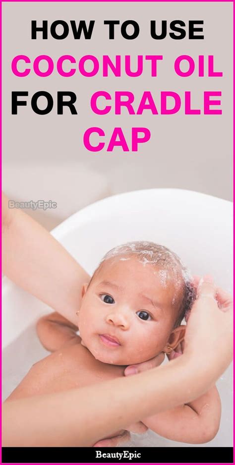 Coconut Oil For Cradle Cap Treatment How To Use Cradle Cap