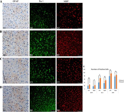 Immunohistochemical Staining Of Gfap A B C And D Iba A