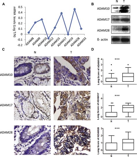 Adam Expression Is Enhanced By Foxm And Is A Poor Prognostic Sign