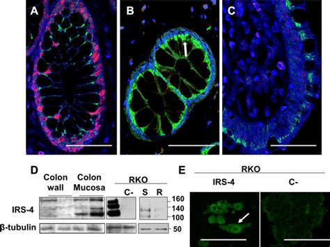 Immunofluorescent Staining Of Irs In Normal Human Colonic Mucosa And