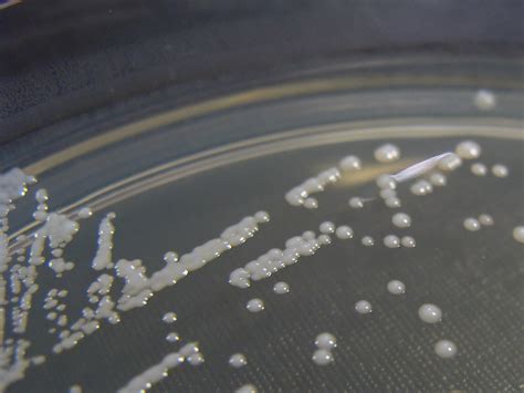 Candida Glabrata Growing On Chromid Candida 2 Agar Detail A Photo