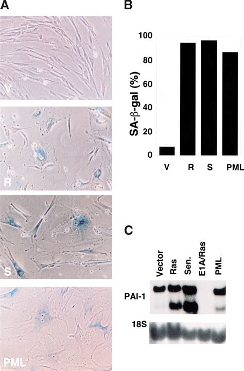 PML Is Induced By Oncogenic Ras And Promotes Premature Senescence