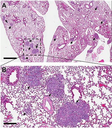 In Vivo Tumor Growth And Spontaneous Metastasis Assays Using A549 Lung