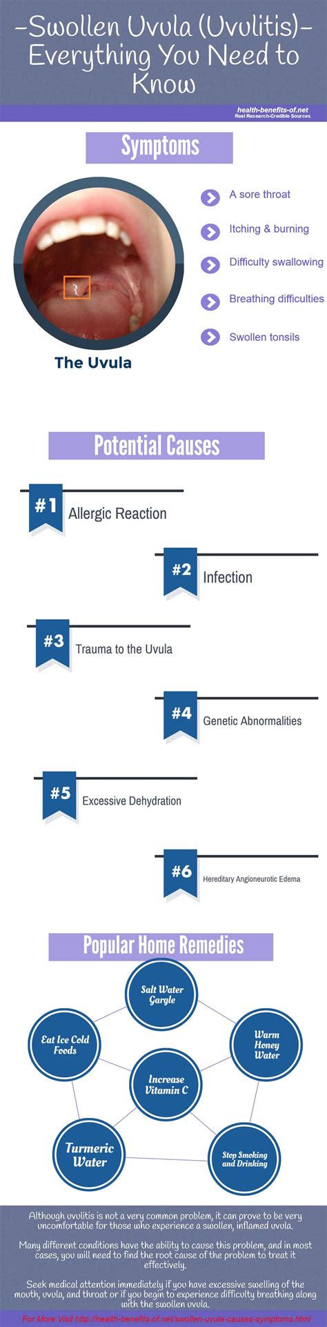 Swollen Uvula - Causes, Symptoms, and Treatment - The Healthy Apron