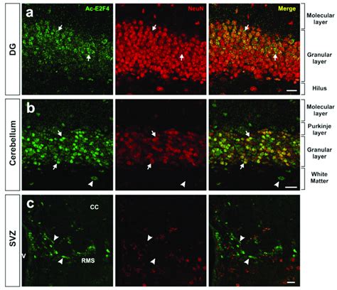 Expression Pattern Of Acetylated E2F4 In The Dentate Gyrus DG A