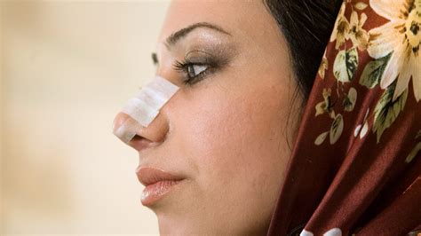 Iran Sees Plastic Surgery Boom During Covid 19 Pandemic Middle East Eye