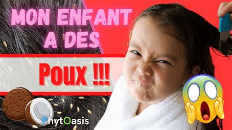 Tuto 5 huiles Essentielles pour se débarrasser des Poux Naturellement