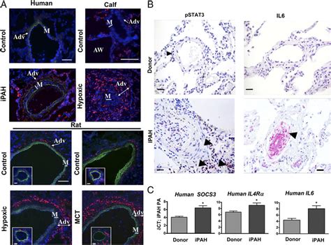 In Various Forms Of Ph Adventitial Macrophages Express Cd163 A Download Scientific Diagram