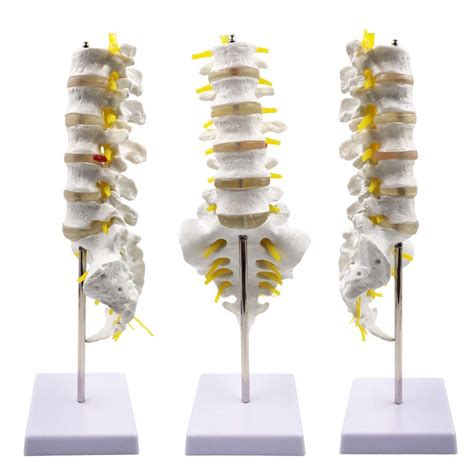 Wellden Medical Anatomical Model Lumbar Vertebrae Australia Ubuy