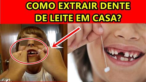 Como Arrancar O Dente De Leite