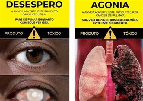 Riscos De Fumar Anvisa Aprova Novas Advertências Para Embalagens De