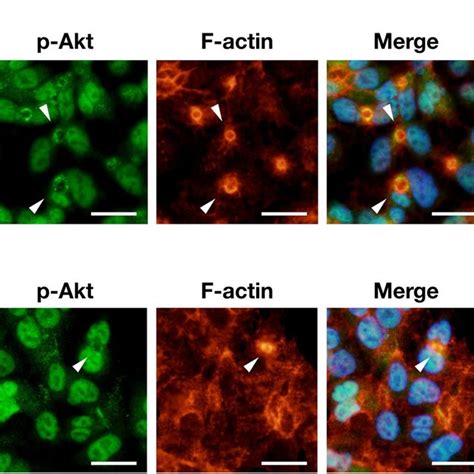 Phospho Akt Localizes To Bile Canalicular Lumen Hepg2 Cells Were