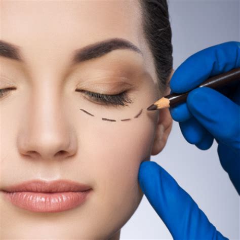 PRP PRFM Under Eye Therapy In Charleston SC