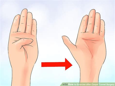 How To Exercise After Carpal Tunnel Surgery With Pictures