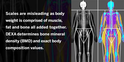 Austin Thyroid Now Offers Dexa Body Composition