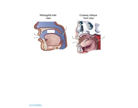 Oral Vestibule and Oral Cavity Quiz