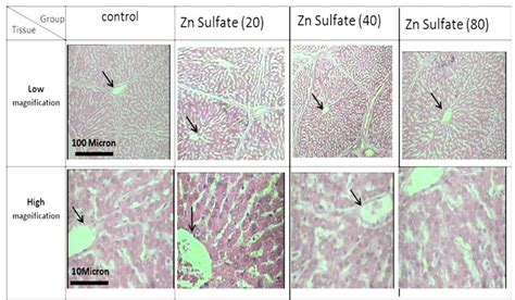 Shows Photomicrograph Section Morphology Of Classic Lobules In The Download Scientific Diagram