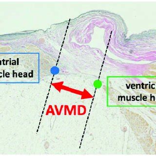 Histology of the right atrioventricular area. (A, B) The area between... | Download Scientific ...