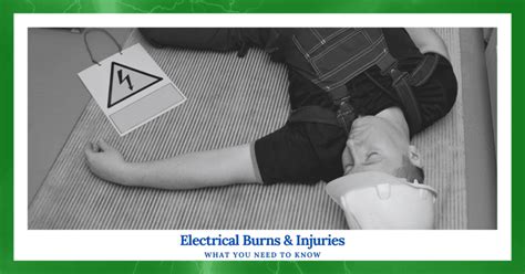 Electrical Burns And Injuries What You Need To Know