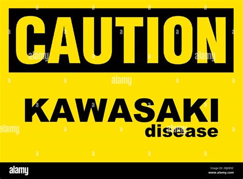 Kawasaki Disease Also Known As Kawasaki Syndrome Mucocutaneous Lymph