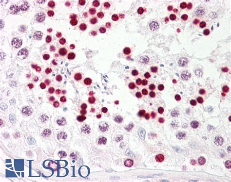 Ihc Plus™ Tp53 P53 Polyclonal Antibody Rabbit Anti Human Lsbio