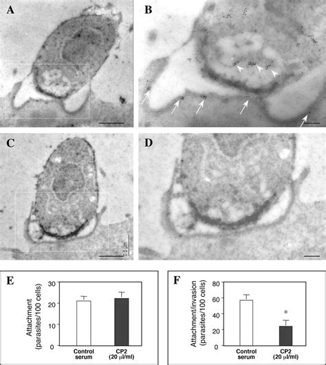 Apical Organelle Discharge By Cryptosporidium Parvum Is Temperature