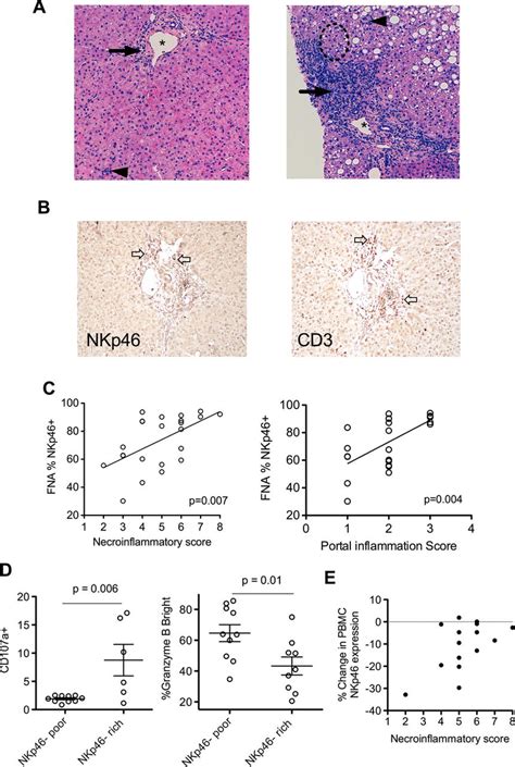 Nkp46 Rich Natural Killer Nk Cell Populations Are More Active And