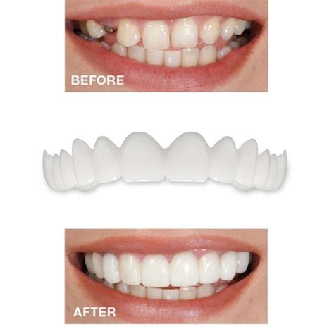 Instant Smile Cosmetic Dentistry Snap On Comfort Fit Flex Teeth Veneers Perfect Ebay