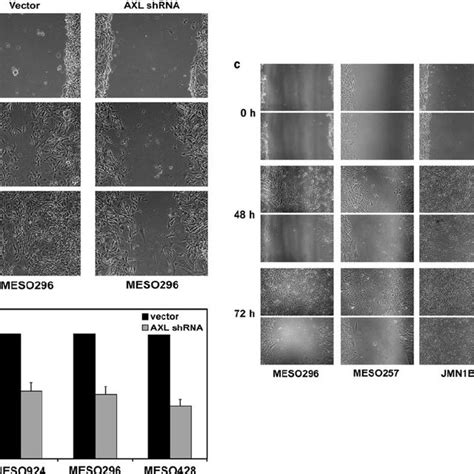 A Lentiviral Shrna Mediated Axl Knockdown Inhibited Migration Of