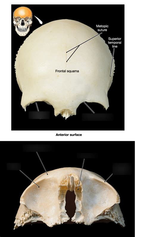 Frontal Bone Diagram | Quizlet