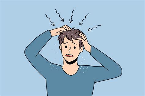 Itchy Head And Dandruff Concept Stressed Irritated Man Standing And