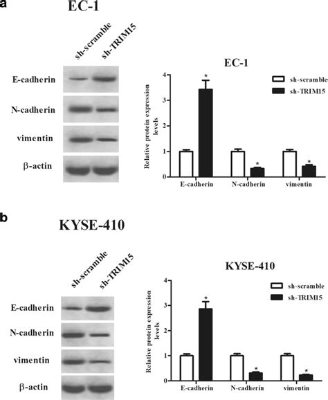 Effects Of Trim15 Knockdown On Emt Process In Escc Cells The