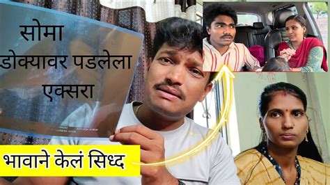 सोमा डोक्यावर पडलेला एक्सरा तुमच्या पुढ😱भावाने केलं सिध्द Youtube