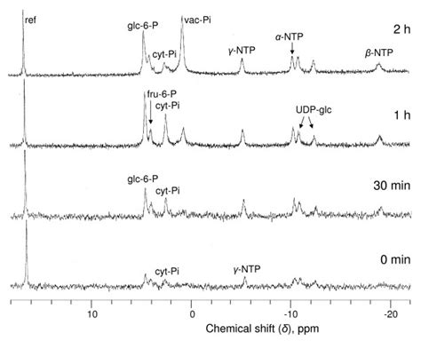 In Vivo Proton Decoupled 31p Nmr Spectra Showing The Recovery Of Download Scientific Diagram