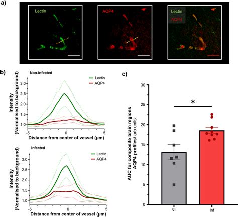 Aquaporin Aqp Water Channel Association With Infection A