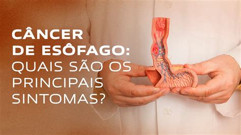 C Ncer De Es Fago Quais S O Os Principais Sintomas Gastromed Youtube