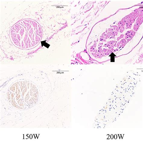 Representative Histological And Immunohistochemical Images Of Nerves In