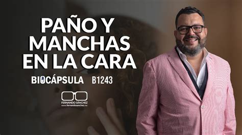 LA RAZÓN DETRÁS DEL PAÑO Y LAS MANCHAS EN LA CARA B1243 Fernando